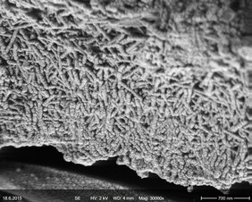 Verkalkte Zellwand von Rotalgen mit einem spezifischen Typ von Nanokristallen aus Kalzit, aufgenommen mit dem Rasterelektronenmikroskop.