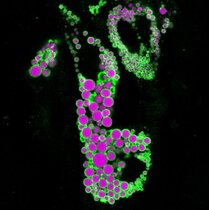 Menschlicher Adipozyt mit magentafarben markierten Lipidtröpfchen und grünem regulatorischem Protein