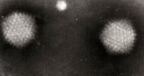 elektronenmikroskopische Abbildung menschlicher Adenoviren