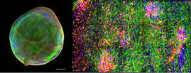 Darstellung eines “Bioengineered Neuronal Organoids” (BENO) hergestellt nach einem von Zafeiriou et al. publiziertem Verfahren