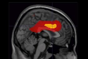 Die Abbildung zeigt einen Schnitt durch das menschliche Gehirn.