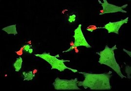 Beispielbild: Natürliche Killerzellen (in rot) in Interaktion mit Zielzellen (grün). 