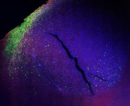 Wo menschliche Tumorzellen und Gehirnzellen einer Maus aufeinandertreffen, haben die Tumorzellen eine andere Identität als überall sonst 