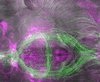 Schlaffördernde Neuronen (grün) und kürzlich aktivierte Neuronen (magenta) im Mausgehirn. 