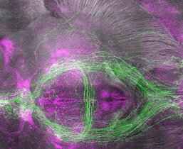 Schlaffördernde Neuronen (grün) und kürzlich aktivierte Neuronen (magenta) im Mausgehirn. Schlaffördernde Neuronen (grün) und kürzlich aktivierte Neuronen (magenta) im Mausgehirn.