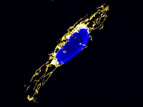 Menschliche Zelle mit Mitochondrien-Netzwerk (gelb) und Zellkern (blau). 