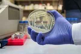 Candida auris ist ein neu auftretender, multiresistenter Pilzerreger, der sich insbesondere in Gesundheitseinrichtungen ausbreitet Hand hält eien Agerplatte mit Pilzbewuchs