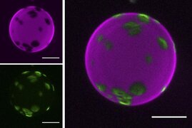 RNA-Lipid-Welt 