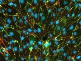 Blut-Hirn-Schranke: Menschliche aus Stammzellen abgeleitete Endothelzellen Blut-Hirn-Schranke: Menschliche aus Stammzellen abgeleitete Endothelzellen