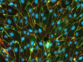 Blut-Hirn-Schranke: Menschliche aus Stammzellen abgeleitete Endothelzellen Blut-Hirn-Schranke: Menschliche aus Stammzellen abgeleitete Endothelzellen