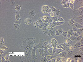 Lichtmikroskopische Aufnahme der Zelllinie CAL-51 (ACC 302)  