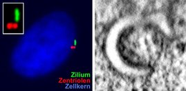 Bislang unbekannte Zwischenstadien der Zilienbildung entdeckt Links: Lichtmikroskopische Aufnahme einer menschlichen retinalen Pigmentepithelzelle. Zellkern, Zentriolen und Zilium sind im Fluoreszenzmikroskop sichtbar gemacht. Rechts: Elektronenmikroskopische Aufnahme eines in der Entstehung befindlichen Ziliums, das die Form eines unvollständigen Donuts aufweist.
