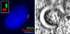 Links: Lichtmikroskopische Aufnahme einer menschlichen retinalen Pigmentepithelzelle. Zellkern, Zentriolen und Zilium sind im Fluoreszenzmikroskop sichtbar gemacht. Rechts: Elektronenmikroskopische Aufnahme eines in der Entstehung befindlichen Ziliums, das die Form eines unvollständigen Donuts aufweist.