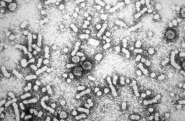 Hepatitis-B virus HBV "Dane particles"