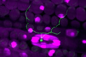 Fluoreszenzmikroskopische Aufnahme von Pilzhyphen, die eine Spaltöffnung des Weizenblatts in der frühen Phase einer Infektion durchwachsen.