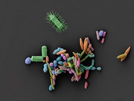 Rasterelektronenmikroskopische Darstellung einer Darmbakteriengemeinschaft 