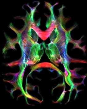 3D-Abbildung der komplexen Nervenfaserstrukturen des Schimpansengehirns. 