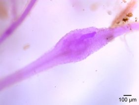 Ein mit Fuchsin gefärbter Wurzelknoten in den Feinwurzeln infizierter Ackersenfpflanzen, der einen juvenilen Nematoden enthält.