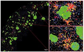 Räumliche RNA-Expression von Botenstoffen von T-Zellen in repräsentativen Hirnregionen eines Mausmodells mit Alzheimer-ähnlicher Erkrankung