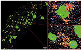 Räumliche RNA-Expression von Botenstoffen von T-Zellen in repräsentativen Hirnregionen eines Mausmodells mit Alzheimer-ähnlicher Erkrankung