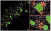 Räumliche RNA-Expression von Botenstoffen von T-Zellen in repräsentativen Hirnregionen eines Mausmodells mit Alzheimer-ähnlicher Erkrankung