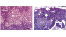 Krebs Thymus