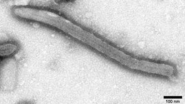 Elektronenmikroskopische Aufnahme eines Ebolavirus in Negativkontrastierung.
