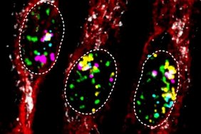 Die fluoreszenzmikroskopische Aufnahme zeigt die TNF-induzierte Expression der Entzündungsgene CXCL1 (cyan), CXCL2 (gelb) und CXCL8 (violett) in menschlichen Zellen 