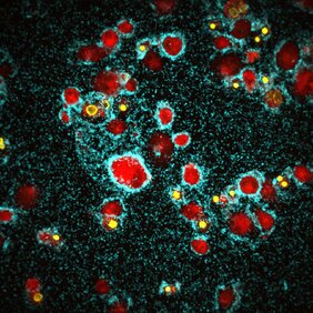 Der Cholera-Erreger Vibrio cholerae  Immunzellen aggressiven Biofilm