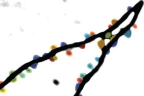 Kommunikation zwischen Nervenzellen findet an Synapsen statt. Hier ist ein Fortsatz einer Nervenzelle aus dem lebenden Gehirn dargestellt, an dem die synaptischen Eingänge farblich hervorgehoben sind. 