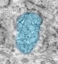 Die Entfernung des Proteins ATR führt zu einer Verformung der Mitochondrien und damit zu Pathologien von Zellen und Nervengewebe. 