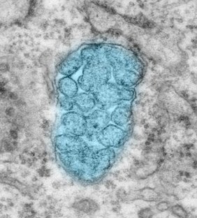 Die Entfernung des Proteins ATR führt zu einer Verformung der Mitochondrien und damit zu Pathologien von Zellen und Nervengewebe. 