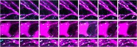 Zeitreihen aus dem Hippocampus lebender Mäuse: Aufnahmen im Abstand von jeweils zwei Tagen zeigen hemmende Synapsen (cyan) an Nervenzellen (magenta)