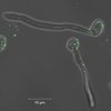 Mit Membranbläschen besetzte Pilzzellen: Die Mikroskopaufnahme zeigt, wie sich von Immunzellen freigesetzte extrazelluläre Vesikel (grün markiert) an Candida albicans anlagern. Mit Membranbläschen besetzte Pilzzellen: Die Mikroskopaufnahme zeigt, wie sich von Immunzellen freigesetzte extrazelluläre Vesikel (grün markiert) an Candida albicans anlagern.