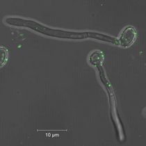 Mit Membranbläschen besetzte Pilzzellen: Die Mikroskopaufnahme zeigt, wie sich von Immunzellen freigesetzte extrazelluläre Vesikel (grün markiert) an Candida albicans anlagern. Mit Membranbläschen besetzte Pilzzellen: Die Mikroskopaufnahme zeigt, wie sich von Immunzellen freigesetzte extrazelluläre Vesikel (grün markiert) an Candida albicans anlagern.