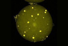In mikroskopischen Untersuchungen entdeckte das Forschungsteam autofluoreszierende Partikel mit einer ausgeprägte Kristallstruktur auf zellulärer Ebene