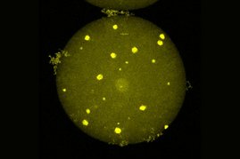 In mikroskopischen Untersuchungen entdeckte das Forschungsteam autofluoreszierende Partikel mit einer ausgeprägte Kristallstruktur auf zellulärer Ebene