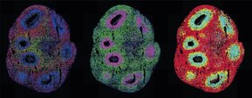  zerebraler Organoide. Verschiedenfarbige Punkte zeigen Transkripte verschiedener Gene an, die mit Molecular Cartography (Resolve Biosciences) aufgenommen wurden.