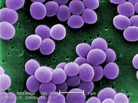Elektronenmikroskopische Abbildung von Staphylococcus aureus