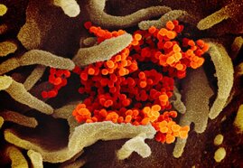 Elektronenmikroskopische Aufnahme von Coronaviren (SARS-Cov-2) 