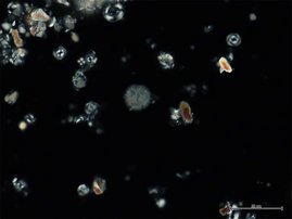 Kalkige Nannofossilien aus dem SW Pazifischen Ozean