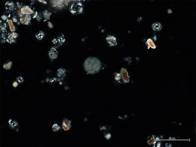 Kalkige Nannofossilien aus dem SW Pazifischen Ozean