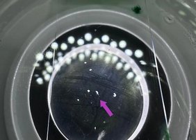 Trichoplax unter einem hochauflösenden Stereomikroskop. Der millimeter-große Meeresbewohner hat weder Organe, Muskeln oder Nerven.