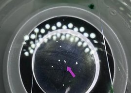 Trichoplax unter einem hochauflösenden Stereomikroskop. Der millimeter-große Meeresbewohner hat weder Organe, Muskeln oder Nerven.