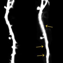 Neuron einer Maus Stress