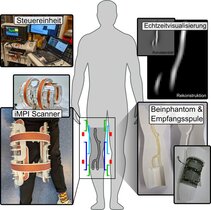 iMPI-Scanner