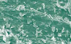Das Abschilfern der Zellen von der Schleimhautoberfläche, hier mit Hilfe des Rasterelektronenmikroskops sichtbar gemacht, gleicht dem Abfallen der Blätter von Bäumen. 