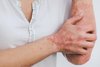 Hand und Arm mit Ekzemen