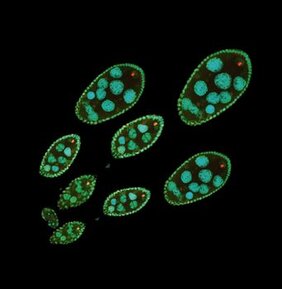  Mit Immunfluoreszenz eingefärbte Eierstöcke einer Drosophila-Fliege mit Eizellen. Die rot gefärbte H4K16ac-Histonmodifikation ist in den einzelnen Eizellen deutlich sichtbar. Das Enzym MOF (grün) ist für die Deposition der H4K16ac-Modifikation verantwortlich. Auch die DNA (blau), Trägerin der Erbninformation, ist sichtbar gemacht worden.
