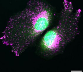  Das Bild zeigt HeLa-Zellen unter dem Mikroskop: Lysosomen sind magenta markiert, die Zellkerne blau und der restliche Zellkörper grün. 